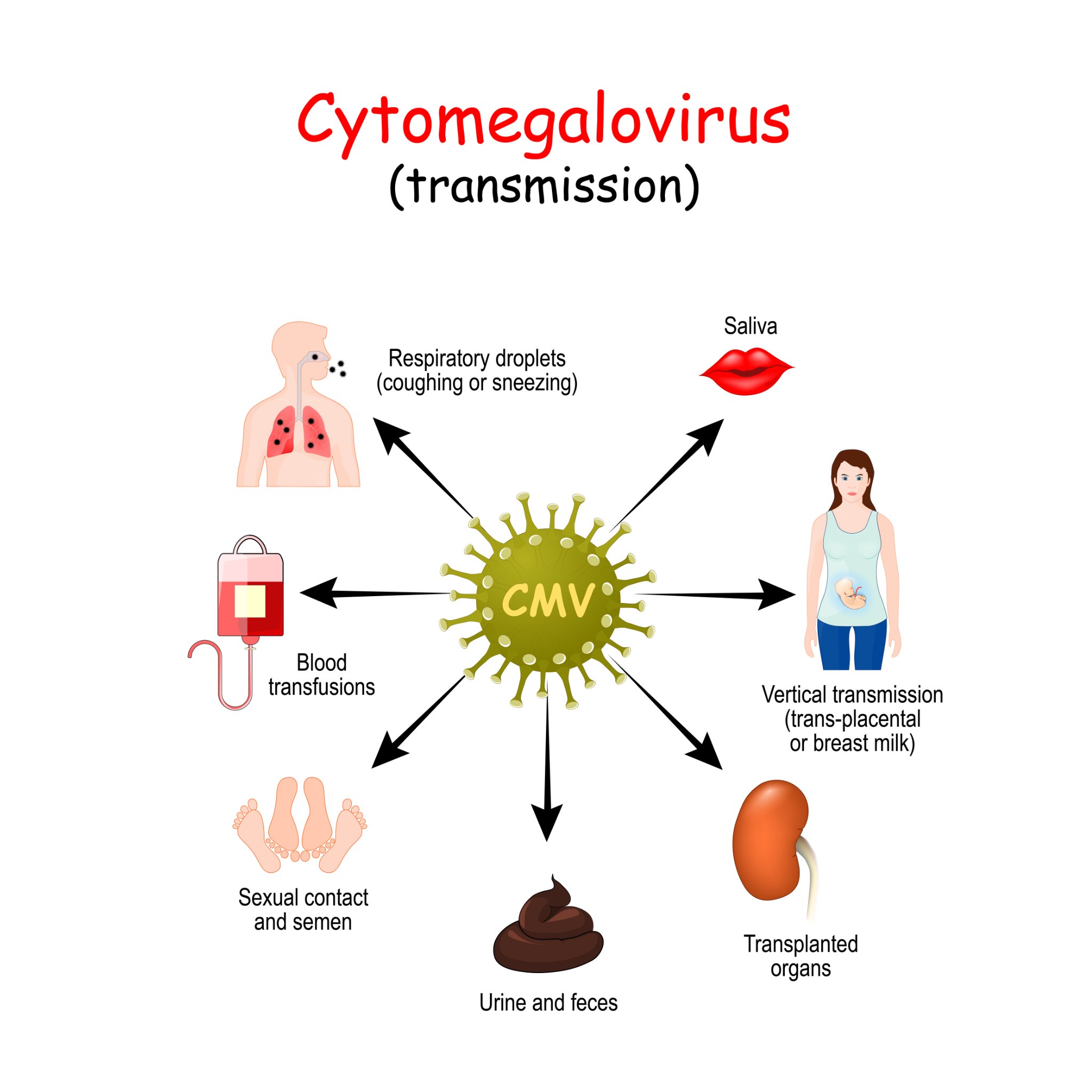Cytomégalovirus causes symptômes et moyens de prévention esculape